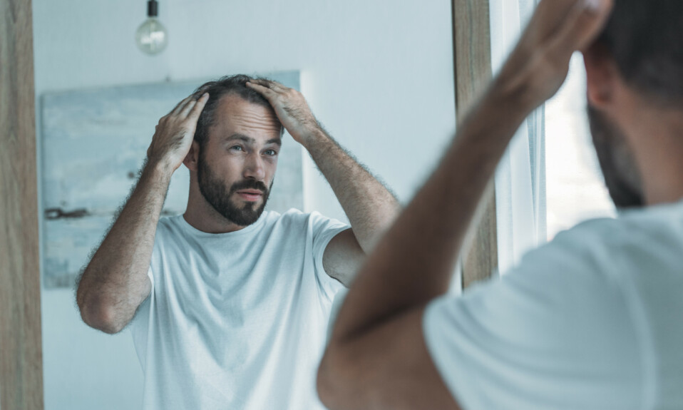 Hair loss or Alopecia, middle aged man looking in the mirror